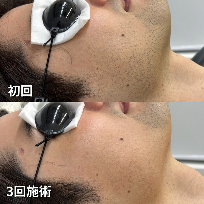 画像1084