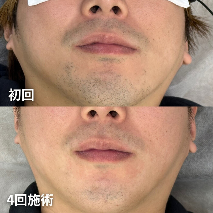 画像1144