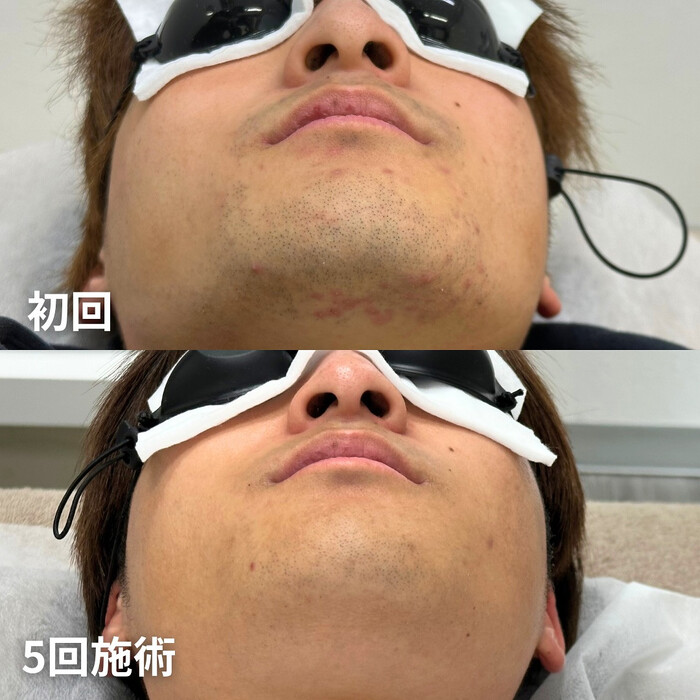 画像1354