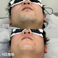 画像1360