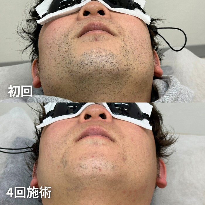 画像1360