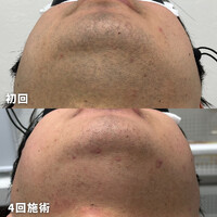 画像1366