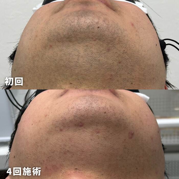 画像1366
