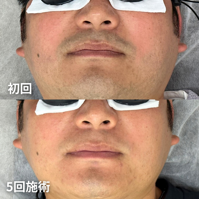 画像1492