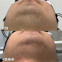 画像1570