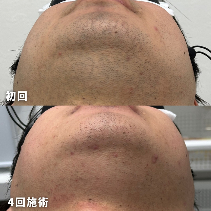 画像1570