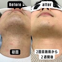 画像311
