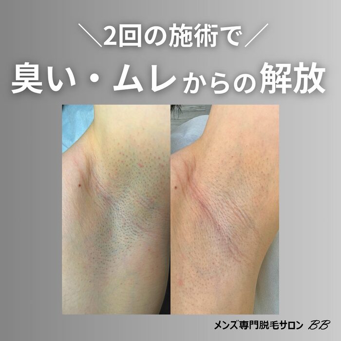 画像320
