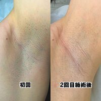 画像321