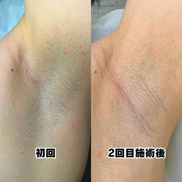 画像321