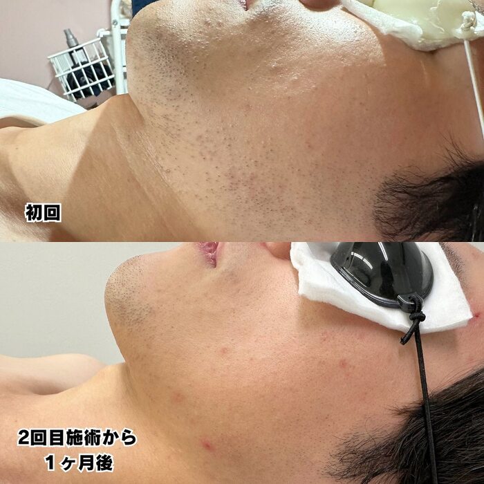 画像360