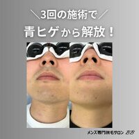 画像379