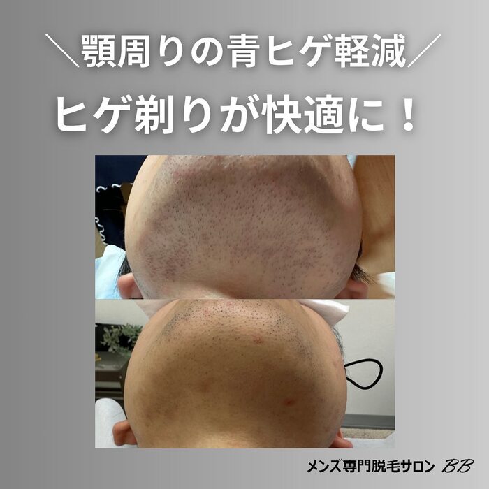 画像389