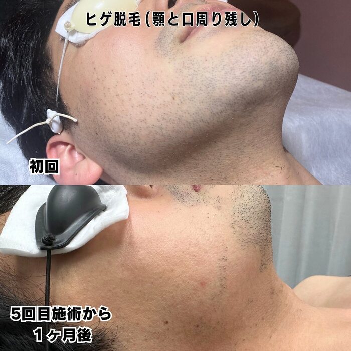 画像400