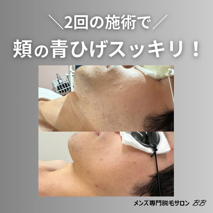 画像419
