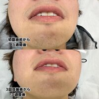 画像430