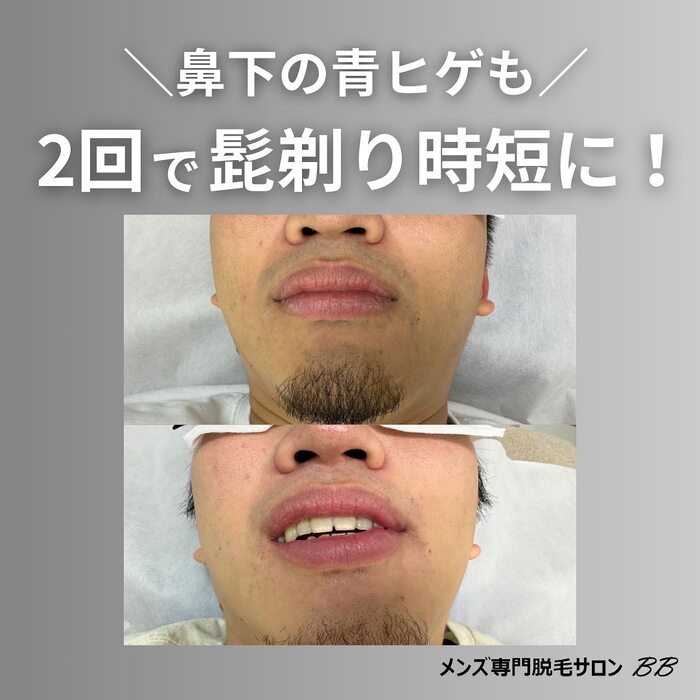 画像439