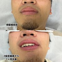 画像440