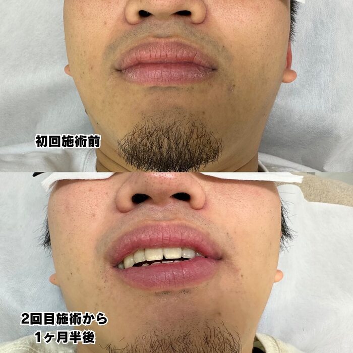 画像440