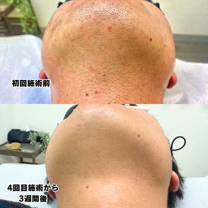 画像460