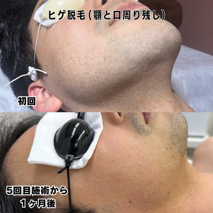 画像476