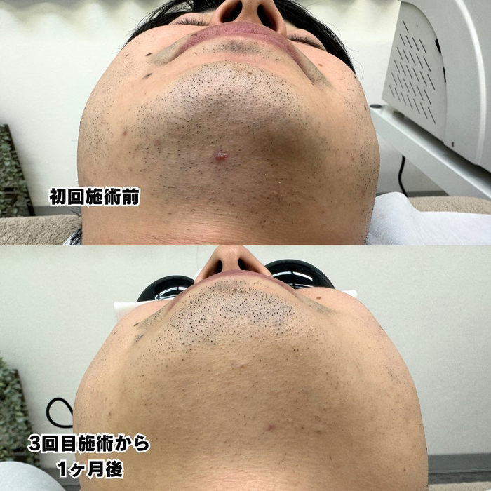 画像495
