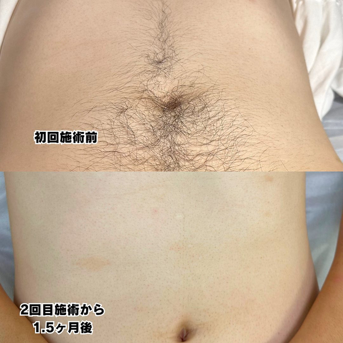 画像505