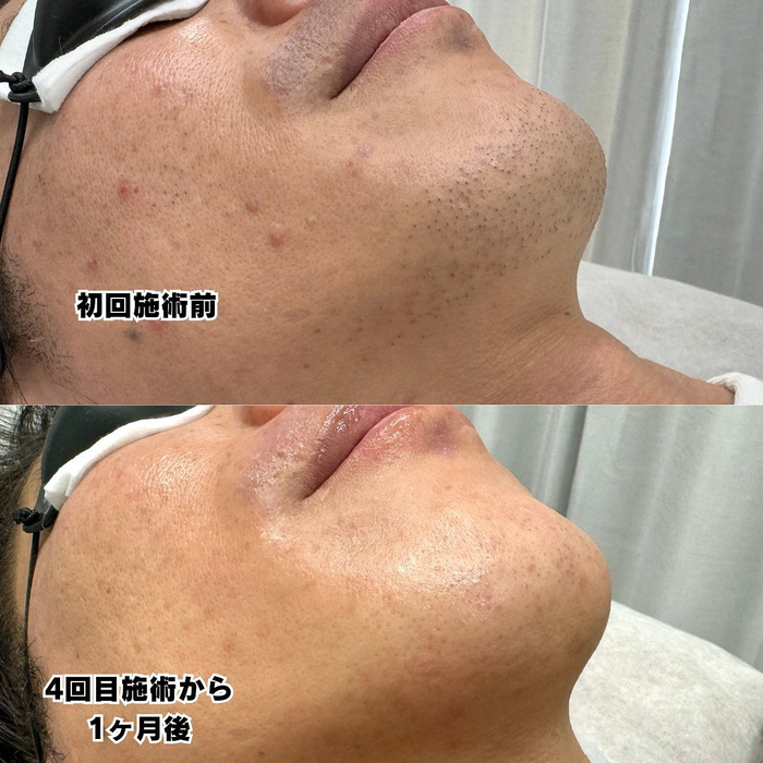 画像535