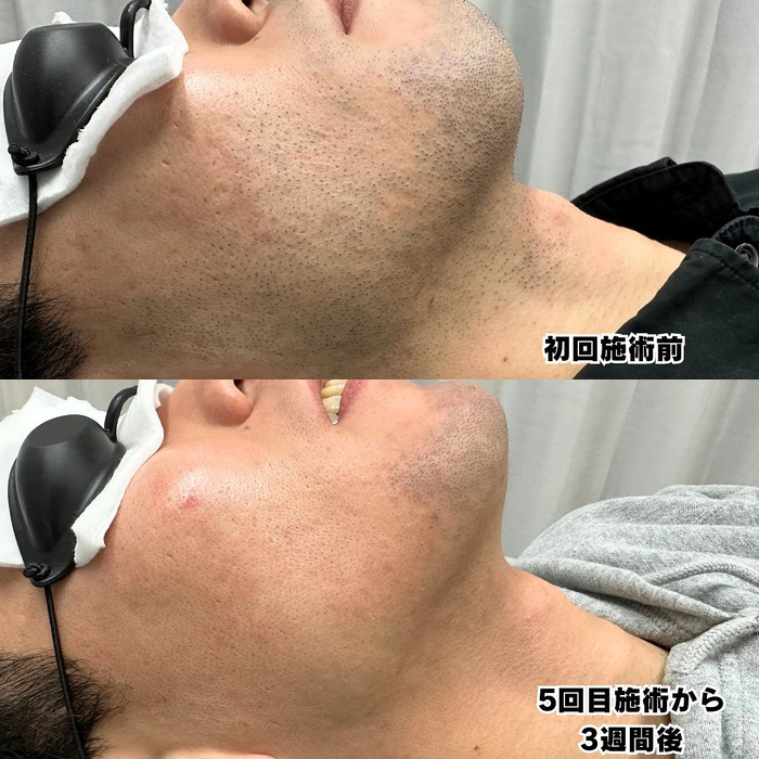 画像575