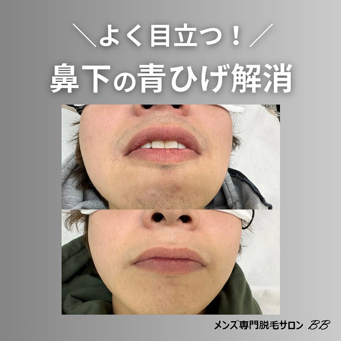 画像624