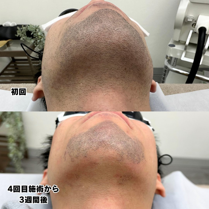 画像655