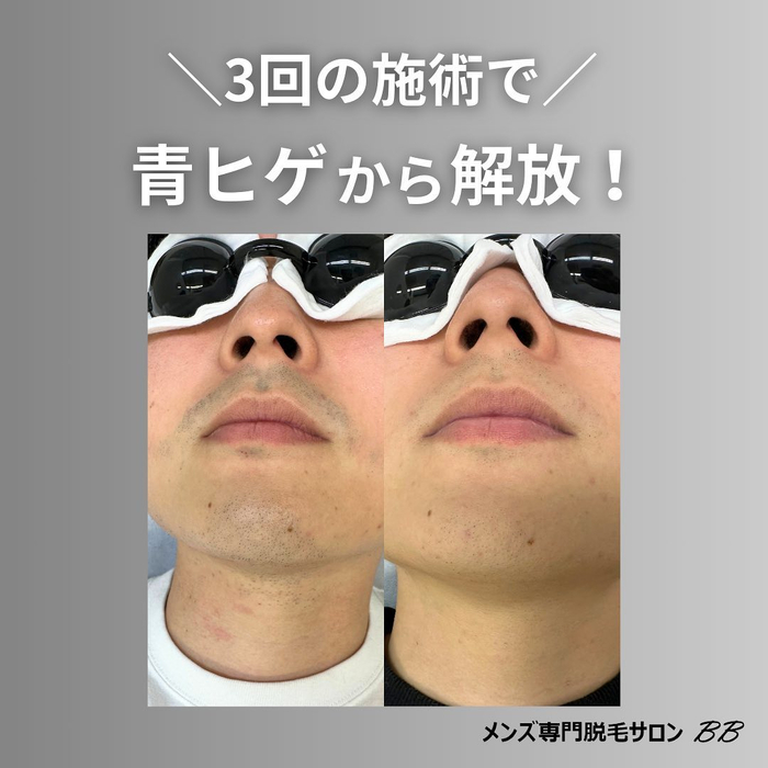 画像734